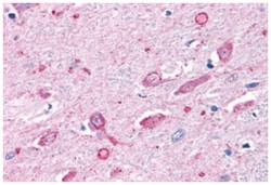 MC4R Rabbit anti-Horse, Human, Monkey, Polyclonal Antibody, Abnova 50 &mu;g | Buy Online | Abnova Corporation | Fisher Scientific