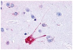 TACR1 Rabbit anti-Bovine, Dog, Human, Monkey, Polyclonal Antibody, Abnova 50 &mu;g | Buy Online | Abnova Corporation | Fisher Scientific
