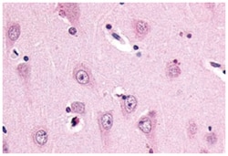 SSTR3, Rabbit, Polyclonal Antibody, Abnova 50 &mu;g | Buy Online | Abnova Corporation | Fisher Scientific