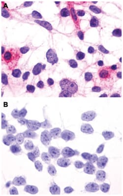 RHO Rabbit anti-Human, Monkey, Mouse, Pig, Rabbit, Rat, Polyclonal Antibody, Abnova 50 &mu;g | Buy Online | Abnova Corporation | Fisher Scientific