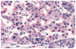 SSTR5 Rabbit anti-Human, Polyclonal Antibody, Abnova 50&mu;g; Unlabeled:Antibodies,