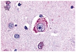MC4R Rabbit anti-Human, Polyclonal Antibody, Abnova 50&mu;g; Unlabeled:Antibodies,