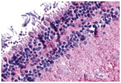 GRM6 Rabbit anti-Bovine, Dog, Hamster, Human, Monkey, Mouse, Pig, Rabbit, Rat, Polyclonal Antibody, Abnova 50 &mu;g | Buy Online | Abnova Corporation | Fisher Scientific