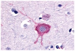 GRM2 Rabbit anti-Dog, Hamster, Human, Rabbit, Rat, Polyclonal Antibody, Abnova 50 &mu;g | Buy Online | Abnova Corporation | Fisher Scientific