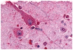 GRM2 Rabbit anti-Hamster, Human, Rabbit, Polyclonal Antibody, Abnova 50&mu;g;