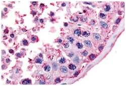 MC5R Rabbit anti-Human, Polyclonal Antibody, Abnova 50 &mu;g | Buy Online | Abnova Corporation | Fisher Scientific