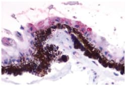 RGR Rabbit anti-Horse, Human, Monkey, Polyclonal Antibody, Abnova 50&mu;g;