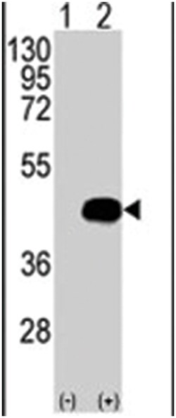 BCKDK Rabbit anti-Human, Polyclonal Antibody, Abnova 400&mu;L; Unlabeled:Antibodies,