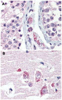 GPR98 Rabbit anti-Human, Polyclonal Antibody, Abnova 50 &mu;g | Buy Online | Abnova Corporation | Fisher Scientific