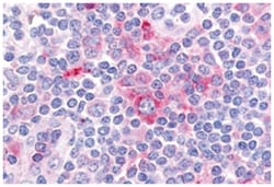 GPR62 Rabbit anti-Human, Polyclonal Antibody, Abnova 50 &mu;g | Buy Online | Abnova Corporation | Fisher Scientific
