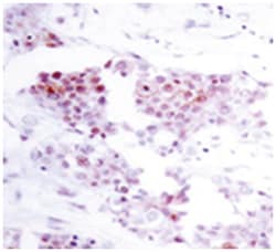MEF2A Rabbit anti-Human, Mouse, Rat, Polyclonal Antibody, Abnova 100 &mu;g | Buy Online | Abnova Corporation | Fisher Scientific