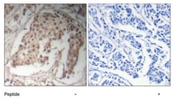 HNF4A Rabbit anti-Human, Mouse, Rat, Polyclonal Antibody, Abnova 100&mu;g;