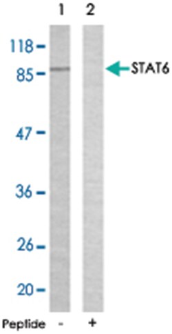 STAT6 Rabbit anti-Human, Polyclonal Antibody, Abnova 100 &mu;g | Buy Online | Abnova Corporation | Fisher Scientific