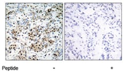 CREB1 Rabbit anti-Human, Mouse, Rat, Polyclonal Antibody, Abnova 100&mu;g;