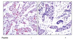 ATF4 Rabbit anti-Human, Polyclonal Antibody, Abnova 100&mu;g; Unlabeled:Antikörper