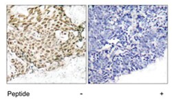 NBN Rabbit anti-Human, Polyclonal Antibody, Abnova 100&mu;g; Unlabeled:Antibodies,