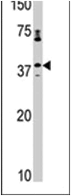 CCRK, Rabbit, Polyclonal Antibody, Abnova 400&mu;L; Unlabeled:Antibodies,