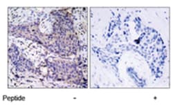 BAD Rabbit anti-Human, Mouse, Rat, Polyclonal Antibody, Abnova 100 &mu;g | Buy Online | Abnova Corporation | Fisher Scientific