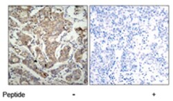BAD Rabbit anti-Human, Mouse, Rat, Polyclonal Antibody, Abnova 100 &mu;g | Buy Online | Abnova Corporation | Fisher Scientific