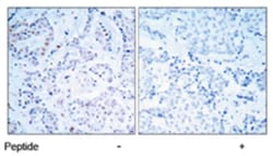 ESR1 Rabbit anti-Human, Mouse, Polyclonal Antibody, Abnova 100 &mu;g | Buy Online | Abnova Corporation | Fisher Scientific