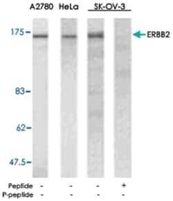 ERBB2 Rabbit anti-Human, Mouse, Rat, Polyclonal Antibody, Abnova 100 &mu;g | Buy Online | Abnova Corporation | Fisher Scientific