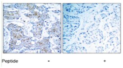 ERBB2 Rabbit anti-Human, Mouse, Rat, Polyclonal Antibody, Abnova 100 &mu;g | Buy Online | Abnova Corporation | Fisher Scientific