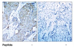 KDR Rabbit anti-Human, Mouse, Rat, Polyclonal Antibody, Abnova 100 &mu;g | Buy Online | Abnova | Fisher Scientific