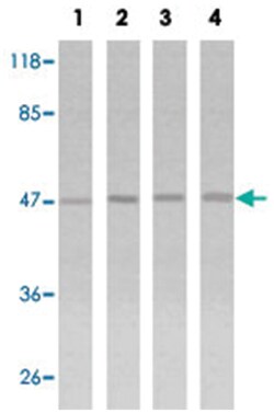 TP53 Rabbit anti-Human, Polyclonal Antibody, Abnova 100 &mu;g | Buy Online | Abnova Corporation | Fisher Scientific