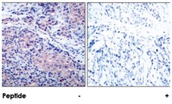 NFKBIA Rabbit anti-Human, Mouse, Rat, Polyclonal Antibody, Abnova 100 &mu;g | Buy Online | Abnova Corporation | Fisher Scientific