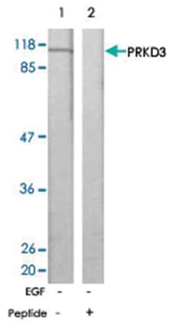 PRKD1 Rabbit anti-Human, Mouse, Rat, Polyclonal Antibody, Abnova 100&mu;g;