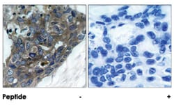 MAP3K5 Rabbit anti-Human, Mouse, Polyclonal Antibody, Abnova 100 &mu;g | Buy Online | Abnova Corporation | Fisher Scientific
