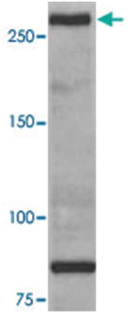 ATM Rabbit anti-Human, Mouse, Polyclonal Antibody, Abnova 100&mu;g; Unlabeled:Antibodies,