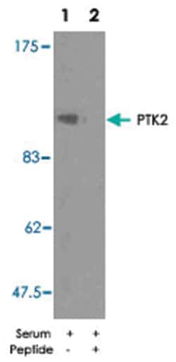 PTK2 Rabbit anti-Human, Mouse, Rat, Polyclonal Antibody, Abnova 100 &mu;g | Buy Online | Abnova Corporation | Fisher Scientific