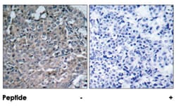 PTK2 Rabbit anti-Human, Mouse, Rat, Polyclonal Antibody, Abnova 100 &mu;g | Buy Online | Abnova Corporation | Fisher Scientific