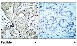 MAP2K6 Rabbit anti-Human, Rat, Polyclonal Antibody, Abnova 100 &mu;g | Buy Online | Abnova Corporation | Fisher Scientific