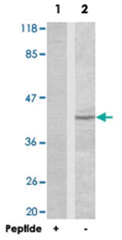 SNCA Rabbit anti-Human, Mouse, Rat, Polyclonal Antibody, Abnova 100&mu;g;