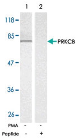 PRKCB Rabbit anti-Human, Mouse, Rat, Polyclonal Antibody, Abnova 100&mu;g;