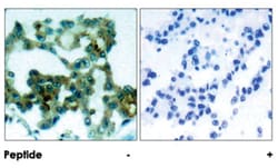 PRKCB Rabbit anti-Human, Mouse, Rat, Polyclonal Antibody, Abnova 100&mu;g;