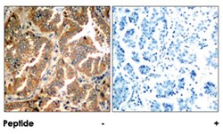 ADD1 Rabbit anti-Human, Mouse, Rat, Polyclonal Antibody, Abnova 100 &mu;g | Buy Online | Abnova Corporation | Fisher Scientific