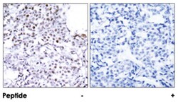 SMC1A Rabbit anti-Human, Mouse, Polyclonal Antibody, Abnova 100 &mu;g | Buy Online | Abnova Corporation | Fisher Scientific