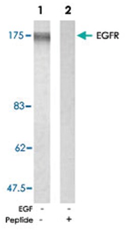 EGFR Rabbit anti-Human, Mouse, Rat, Polyclonal Antibody, Abnova 100&mu;g;