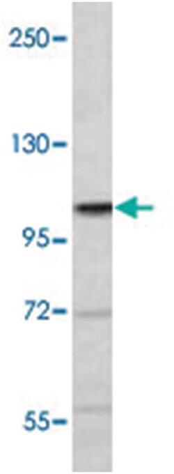 ERN2 Rabbit anti-Human, Polyclonal Antibody, Abnova 400 &mu;L | Buy Online | Abnova Corporation | Fisher Scientific