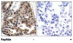 EIF4EBP1 Rabbit anti-Human, Mouse, Rat, Polyclonal Antibody, Abnova 100&mu;g;