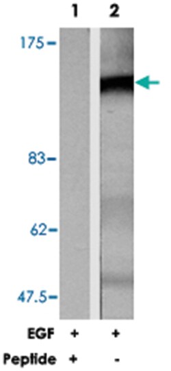 KIT Rabbit anti-Human, Mouse, Rat, Polyclonal Antibody, Abnova 100 &mu;g | Buy Online | Abnova | Fisher Scientific