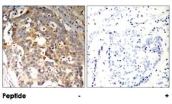 MAPK9/MAPK10 Rabbit anti-Human, Mouse, Rat, Polyclonal Antibody, Abnova 100 &mu;g | Buy Online | Abnova Corporation | Fisher Scientific