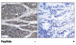 NFKB1 Rabbit anti-Human, Mouse, Rat, Polyclonal Antibody, Abnova 100&mu;g;