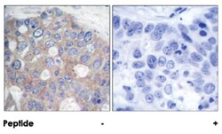 RPS6KB1 (phospho T421), Rabbit anti-Human, Mouse, Rat, Polyclonal Antibody, Abnova 100 &mu;g | Buy Online | Abnova Corporation | Fisher Scientific