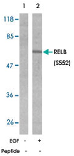 RELB (phospho S552), Rabbit anti-Human, Mouse, Rat, Polyclonal Antibody, Abnova 100 &mu;g | Buy Online | Abnova Corporation | Fisher Scientific
