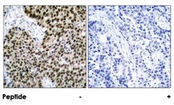 HSF1 Rabbit anti-Human, Polyclonal Antibody, Abnova 100 &mu;g | Buy Online | Abnova Corporation | Fisher Scientific