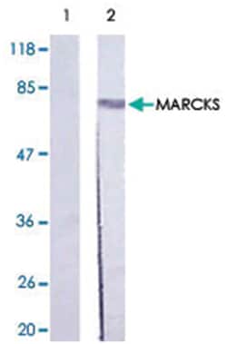 MARCKS Rabbit anti-Human, Mouse, Rat, Polyclonal Antibody, Abnova 100 &mu;g | Buy Online | Abnova | Fisher Scientific